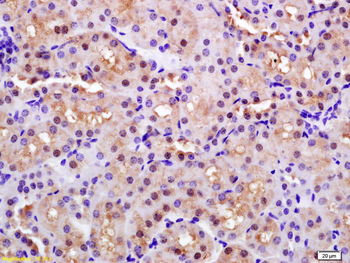 PARK7/DJ1 Rabbit Polyclonal Antibody
