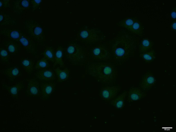 E2F1 Rabbit Polyclonal Antibody