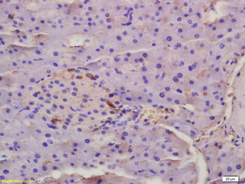 EDA Rabbit Polyclonal Antibody