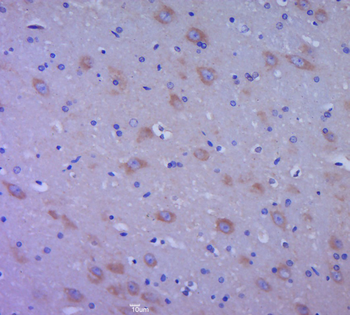 EGF Rabbit Polyclonal Antibody