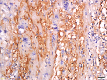 SFRP4 Rabbit Polyclonal Antibody