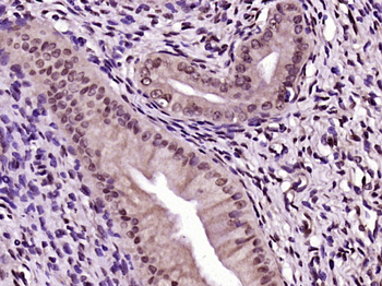 ERCC1 Rabbit Polyclonal Antibody