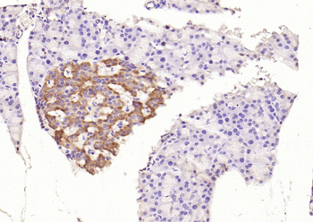 Phospho-IRS1 (Ser312) Rabbit Polyclonal Antibody