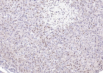Estrogen receptor beta Rabbit Polyclonal Antibody