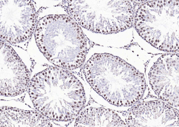 Estrogen receptor beta Rabbit Polyclonal Antibody
