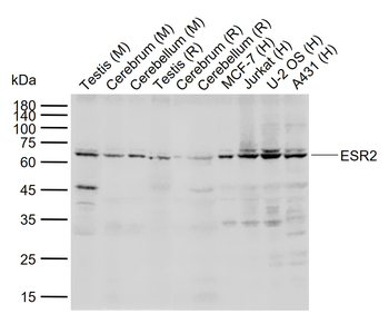 Estrogen receptor beta Rabbit Polyclonal Antibody