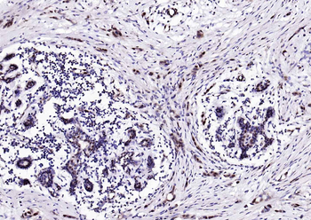 Estrogen receptor beta Rabbit Polyclonal Antibody