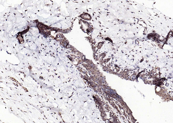 Estrogen receptor beta Rabbit Polyclonal Antibody