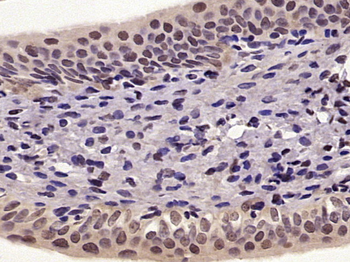 Phospho-NFKB p65 (Ser276) Rabbit Polyclonal Antibody