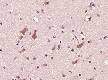Phospho-ASK1 (Ser966) Rabbit Polyclonal Antibody