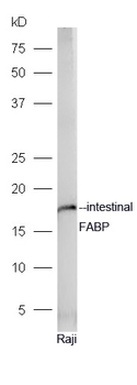 Intestinal FABP Rabbit Polyclonal Antibody