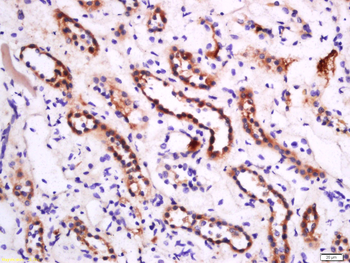 APOA1 Rabbit Polyclonal Antibody