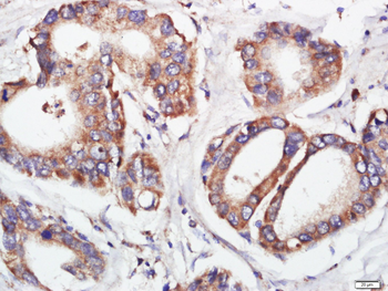 FGFR2 Rabbit Polyclonal Antibody
