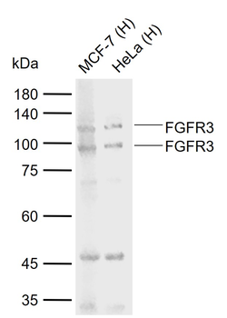 FGFR3 Rabbit Polyclonal Antibody