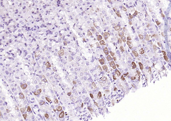 FGFR4 Rabbit Polyclonal Antibody