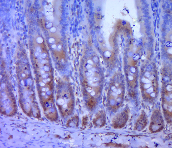 FOXO3A Rabbit Polyclonal Antibody