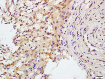 FSH receptor Rabbit Polyclonal Antibody