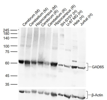 GAD65 Rabbit Polyclonal Antibody