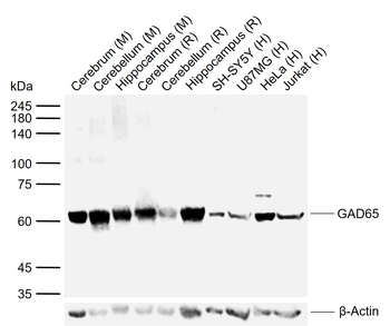 GAD65 Rabbit Polyclonal Antibody