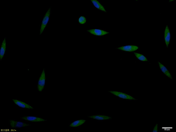 GAD65 Rabbit Polyclonal Antibody