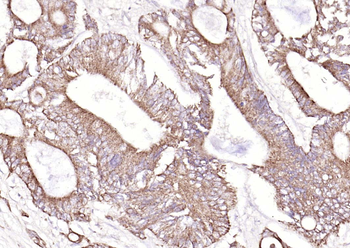Galectin 3 Rabbit Polyclonal Antibody
