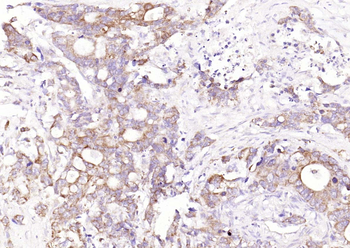 Galectin 3 Rabbit Polyclonal Antibody