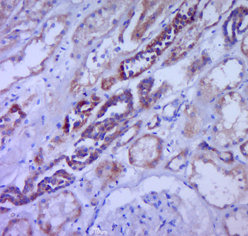 G-CSF/CSF3 Rabbit Polyclonal Antibody