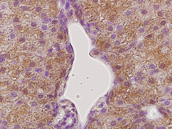 Growth hormone receptor Rabbit Polyclonal Antibody