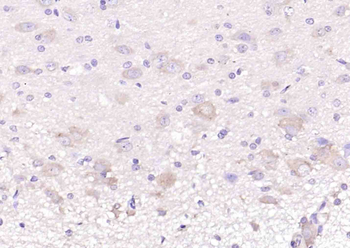 GHRH Rabbit Polyclonal Antibody