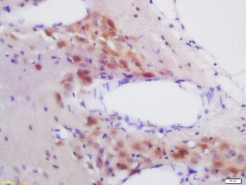 GLP-1R Rabbit Polyclonal Antibody