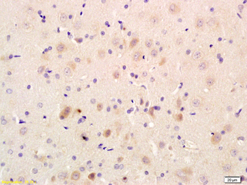 GLUT3 Rabbit Polyclonal Antibody