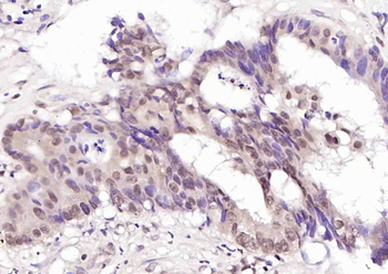 GRB2 Rabbit Polyclonal Antibody