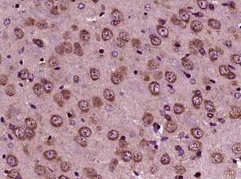GRP94 Rabbit Polyclonal Antibody