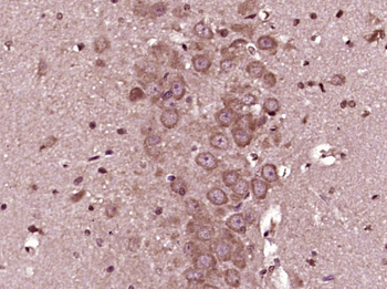GSK-3 Beta Rabbit Polyclonal Antibody
