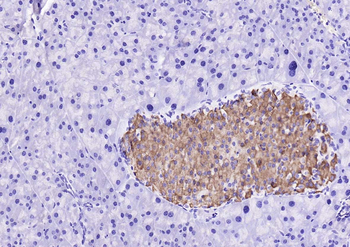 GSK-3 Beta Rabbit Polyclonal Antibody