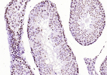 Histone H3 Rabbit Polyclonal Antibody (Nuclear Loading Control)