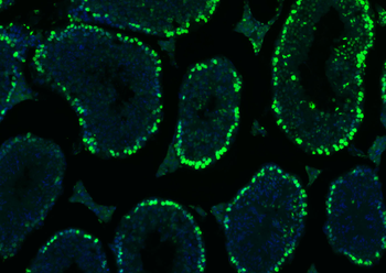 Histone H3 Rabbit Polyclonal Antibody (Nuclear Loading Control)