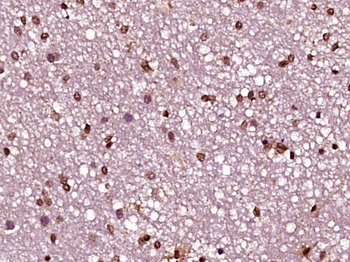 Histone H1.4 (Acetyl K53) Rabbit Polyclonal Antibody