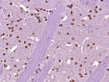 Histone H1.4 (Acetyl K53) Rabbit Polyclonal Antibody