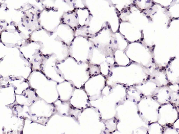 Histone H1.4 (Acetyl K53) Rabbit Polyclonal Antibody