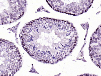 Histone H1.4 (Acetyl K53) Rabbit Polyclonal Antibody