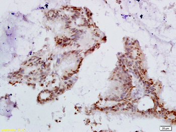 HPV16 E6 + HPV18 E6 Rabbit Polyclonal Antibody