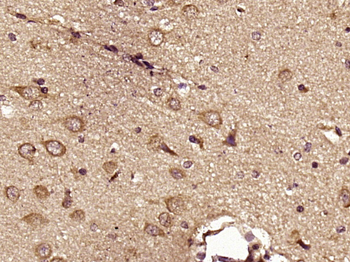 HSL/LIPE Rabbit Polyclonal Antibody