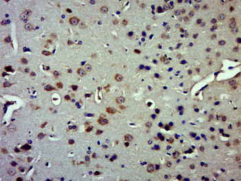 IDE Rabbit Polyclonal Antibody