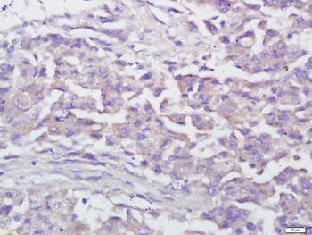IFN gamma Mouse Monoclonal Antibody