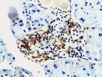 IGF2BP3 Rabbit Polyclonal Antibody