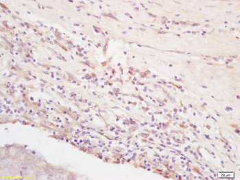 Integrin Alpha V Rabbit Polyclonal Antibody