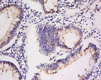Integrin Alpha V + Beta 5 Rabbit Polyclonal Antibody