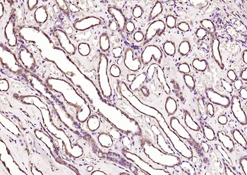 KRAS Rabbit Polyclonal Antibody