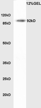 LDLR Rabbit Polyclonal Antibody